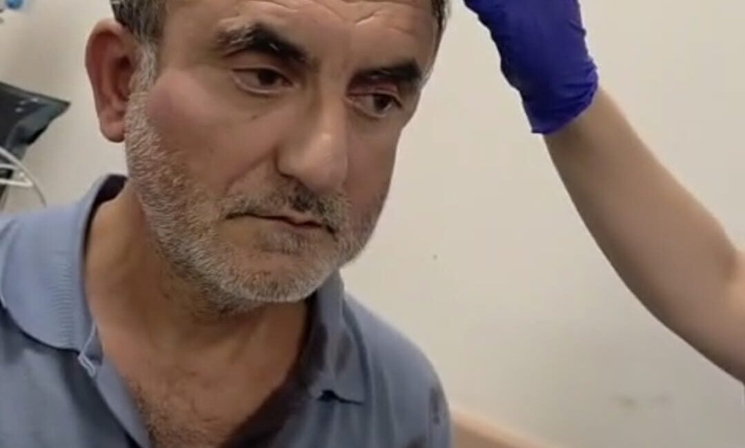 Alican GÜMÜŞ/ HATAY, – HATAY’da Samandağ Ekoloji Grubu Sözcüsü Mevlüt