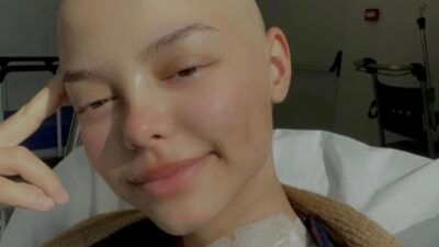 Ruken KADIOĞLU-Canberk ÖZTÜRK/ANKARA, – ANKARA’da 2 yıldır lenf kanseri ile