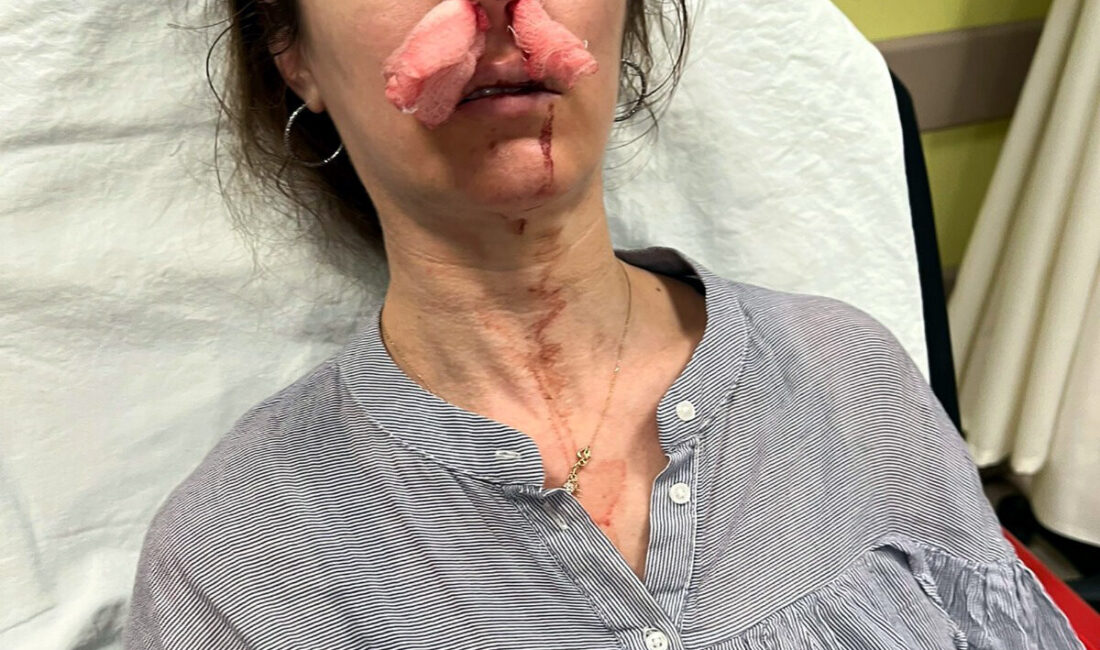 Olgay GÜLER/EDİRNE, – EDİRNE’de, Y.K.’nin (47), Hamiyet Pehlivan Bingül’ü, eşinin