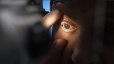 İSTANBUL, – SAĞ gözünde doğumsal ve kalıtsal hastalığın yol açtığı