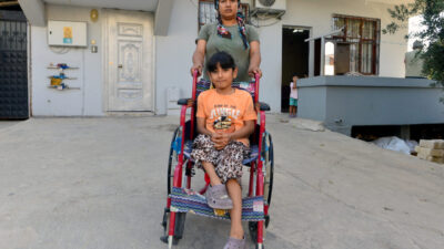 Anıl ATAR-Yusuf YILDIZ/ADANA, – ADANA’da femur kısalığı nedeniyle sağ bacağı