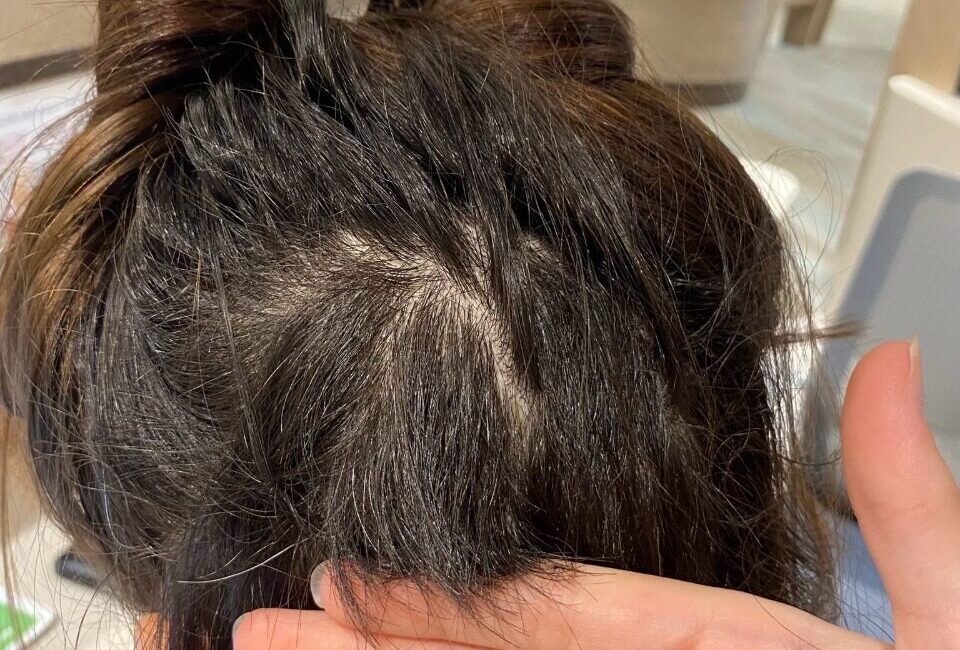 Gülseren KARAPINAR-Fırat ALKIZ/İSTANBUL, İSTANBUL, – İstanbul’da özel bir hastanede hemşire