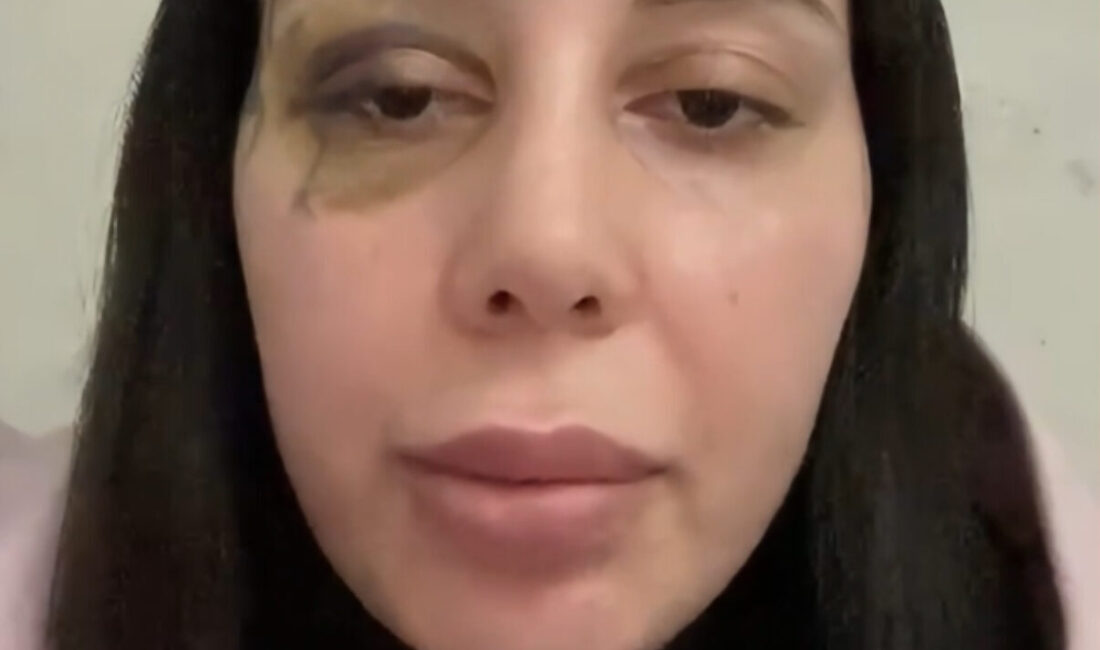 Doğan Can CESUR / İSTANBUL – KAĞITHANE’de Yağmur Serin E.