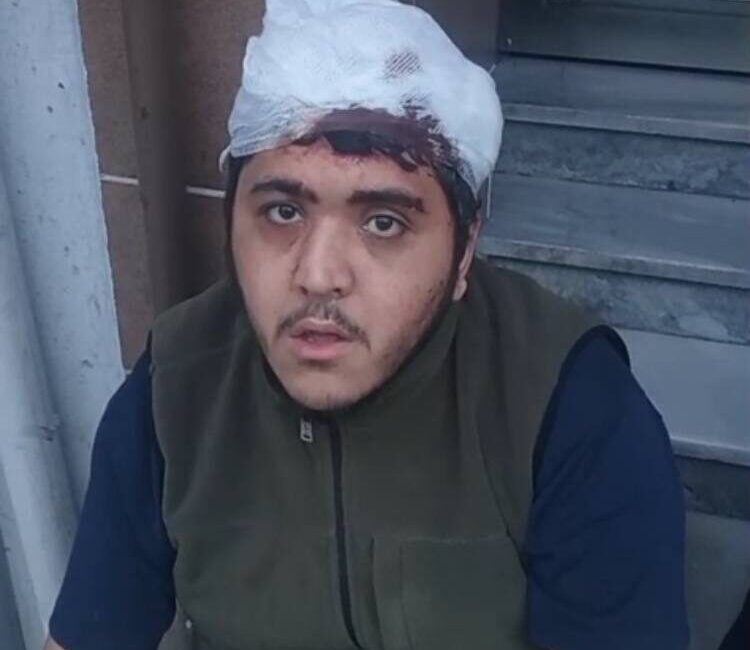 Baran AKKAYA-Emin YEŞİL/İSTANBUL, – Sultangazi’de annesiyle beraber ablasını ziyarete giden