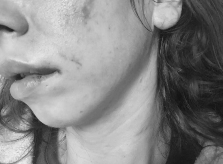 Ceren KÜP / İSTANBUL, – ÇEKMEKÖY’de eşi S.N.A.’yı (30) darbederek